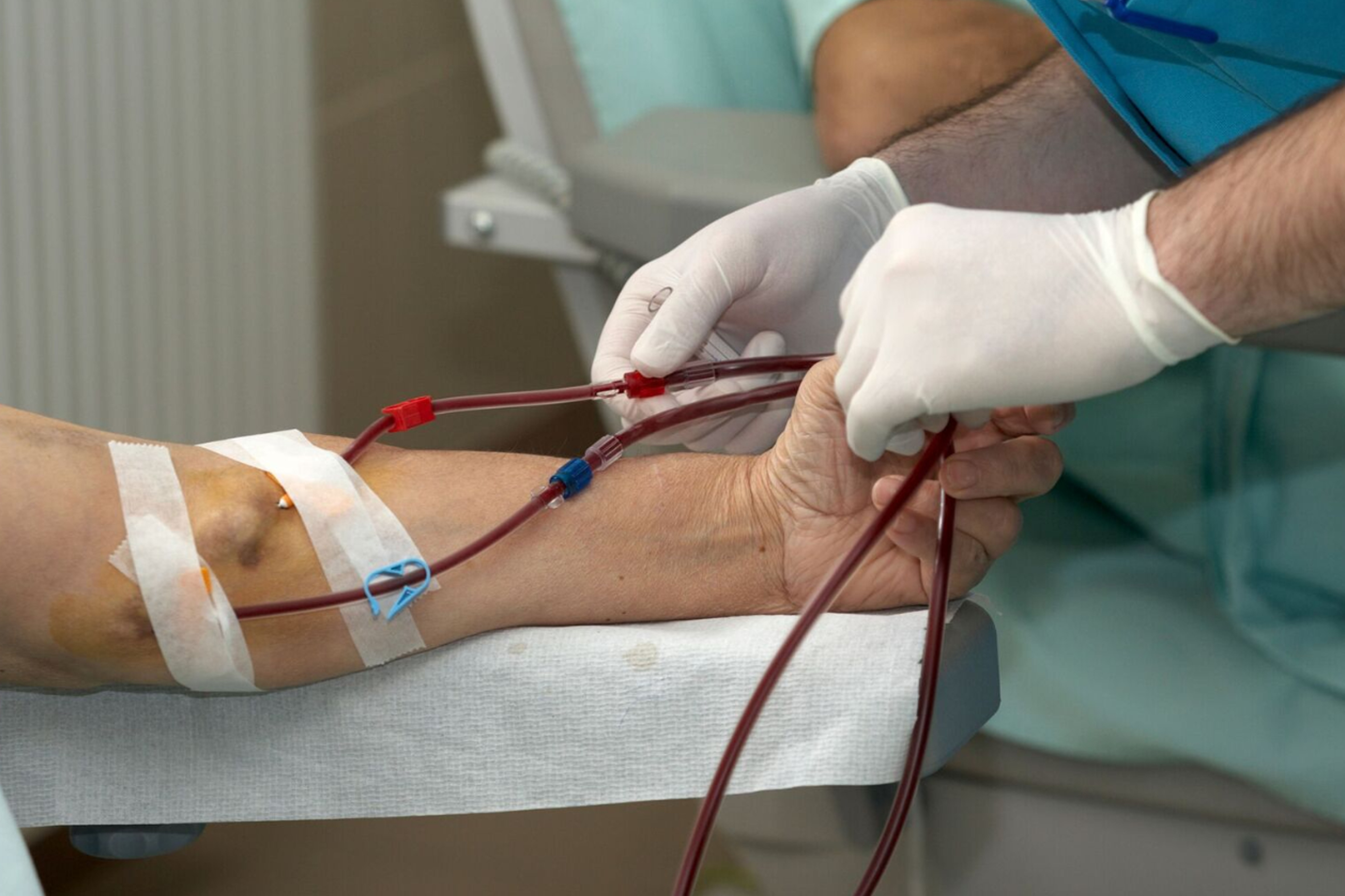 Hemodialysis Access Care